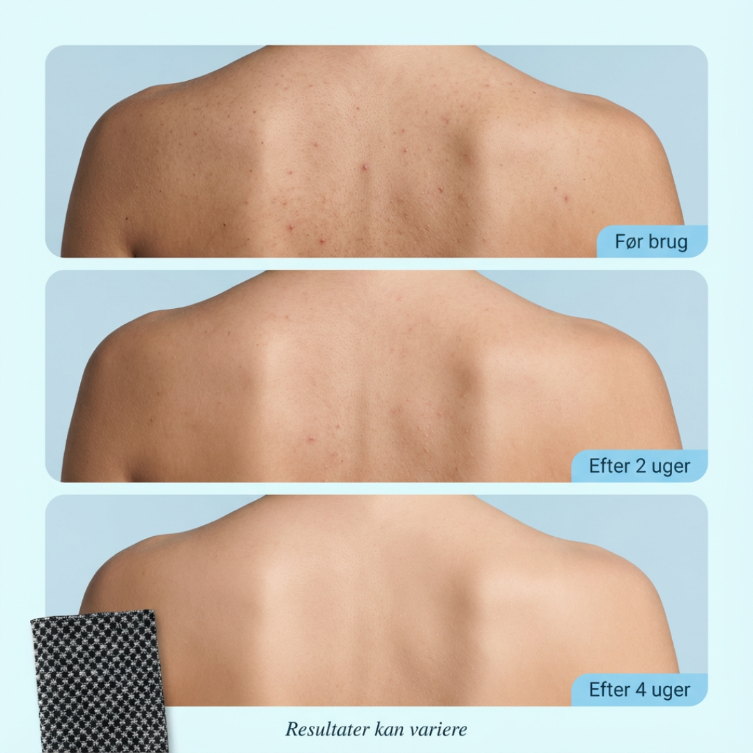 FjordTowel™ - Eksfolierende badehåndklæde for silkeblød hud.