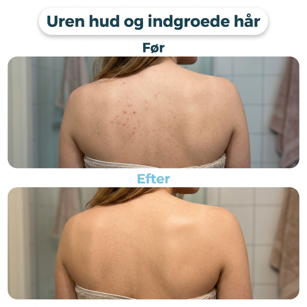 FjordTowel™ - Eksfolierende badehåndklæde for glat og silkeblød hud.